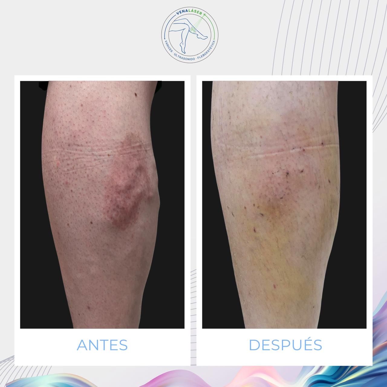 Mishell Eduardo Santander Becerra-7