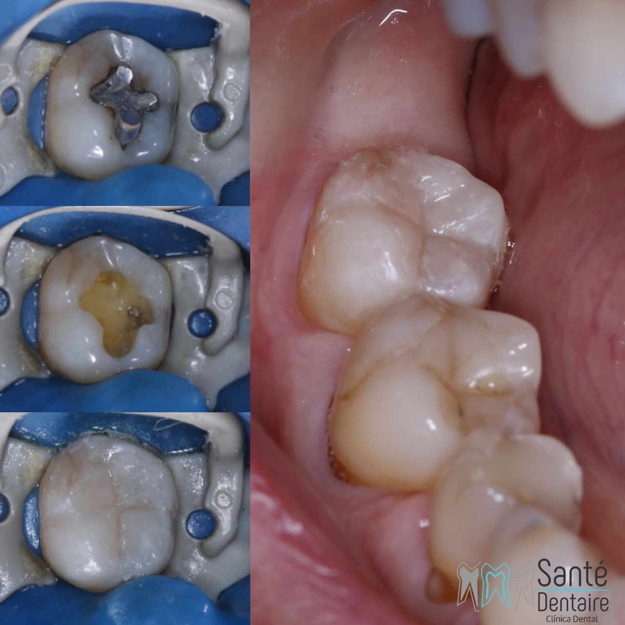 Daniel Oñate Robledo-15