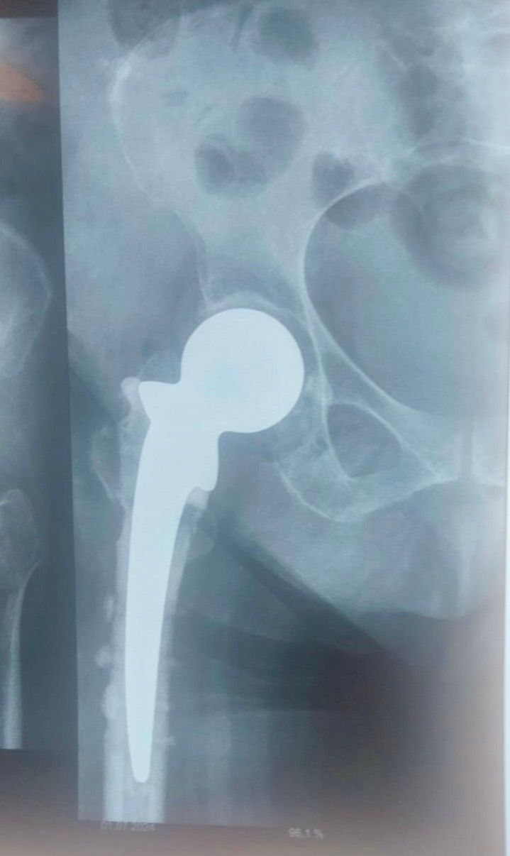 Irving Alejandro Mendoza Padilla-1