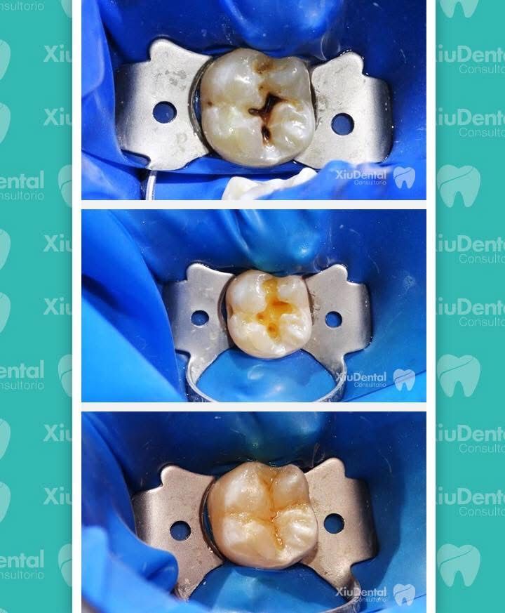 Xiuhnel Solorio Cuevas-12