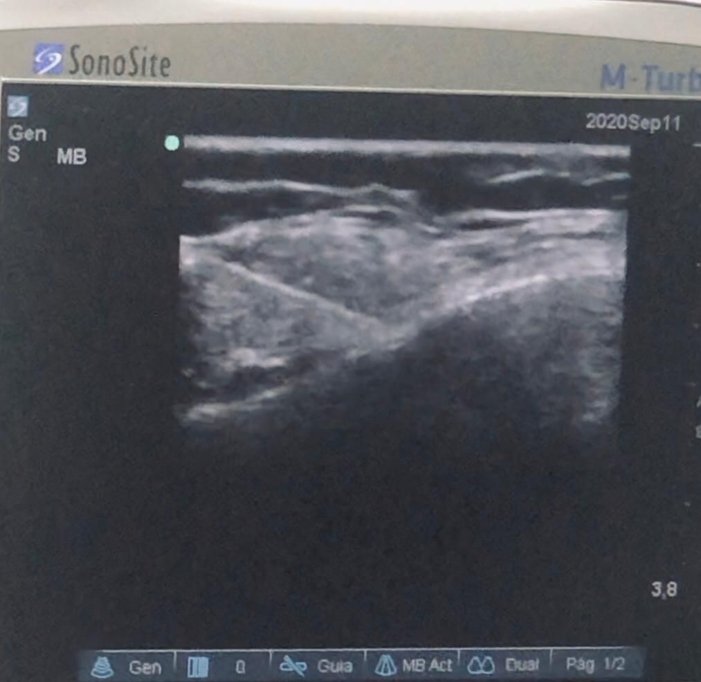 Cristina Isabel Almazan Chouza-11