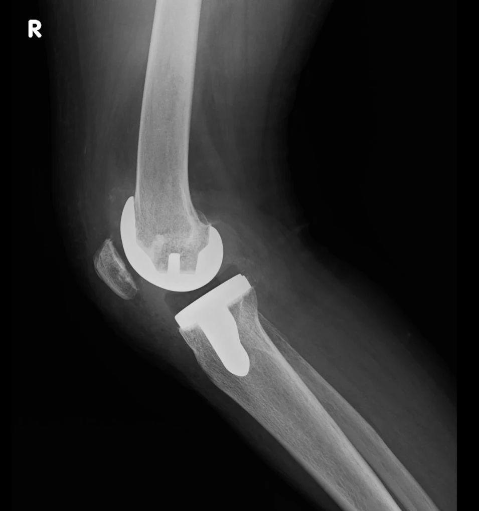 Eduardo Anaya Duran-4