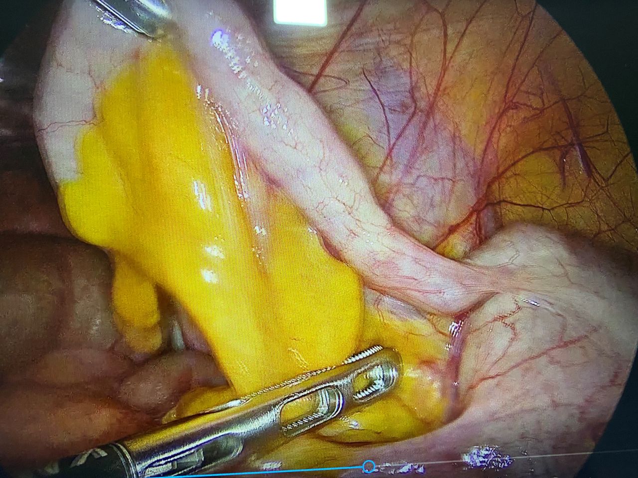 Mariann Barajas Grijalva-14