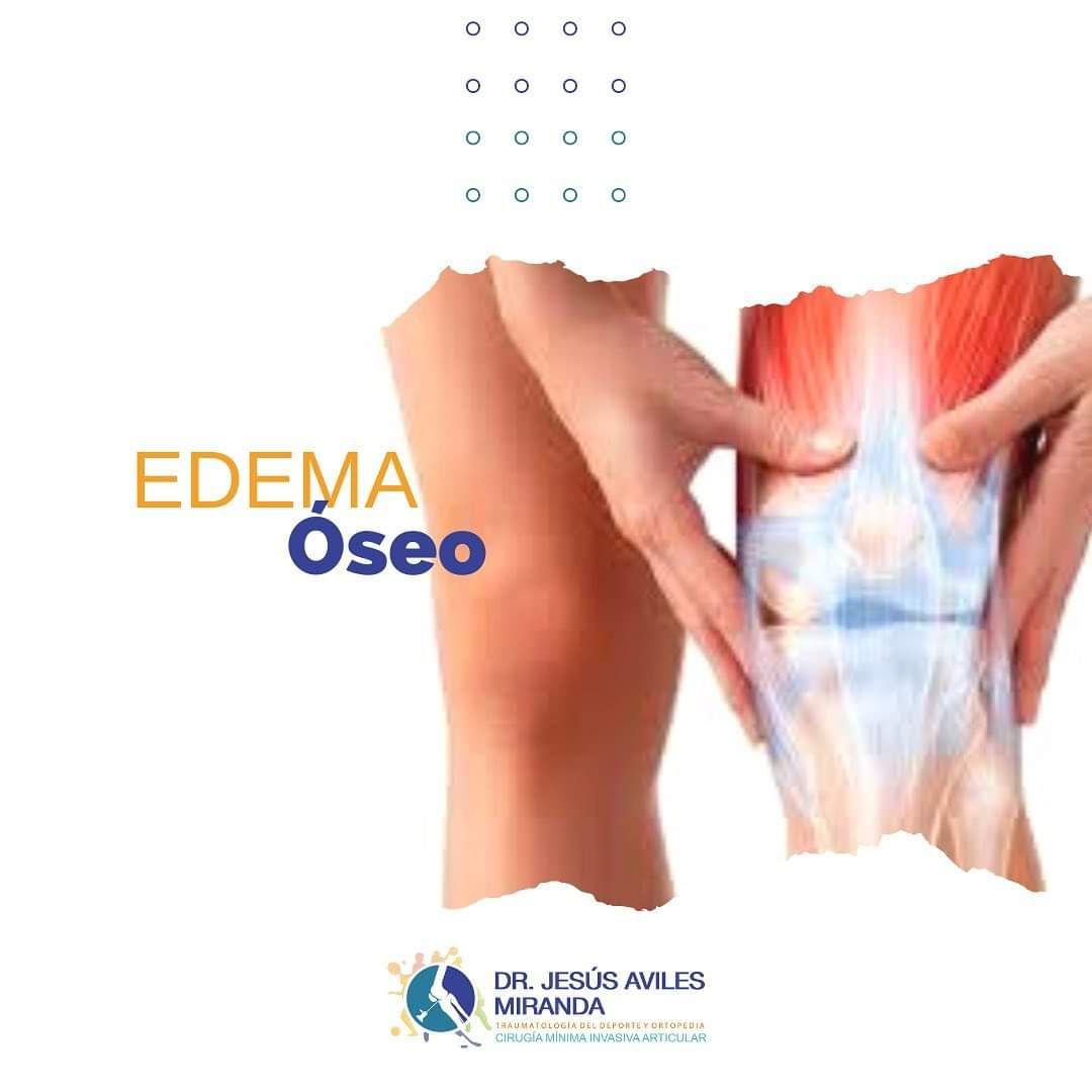 Jesús Aviles Miranda-11