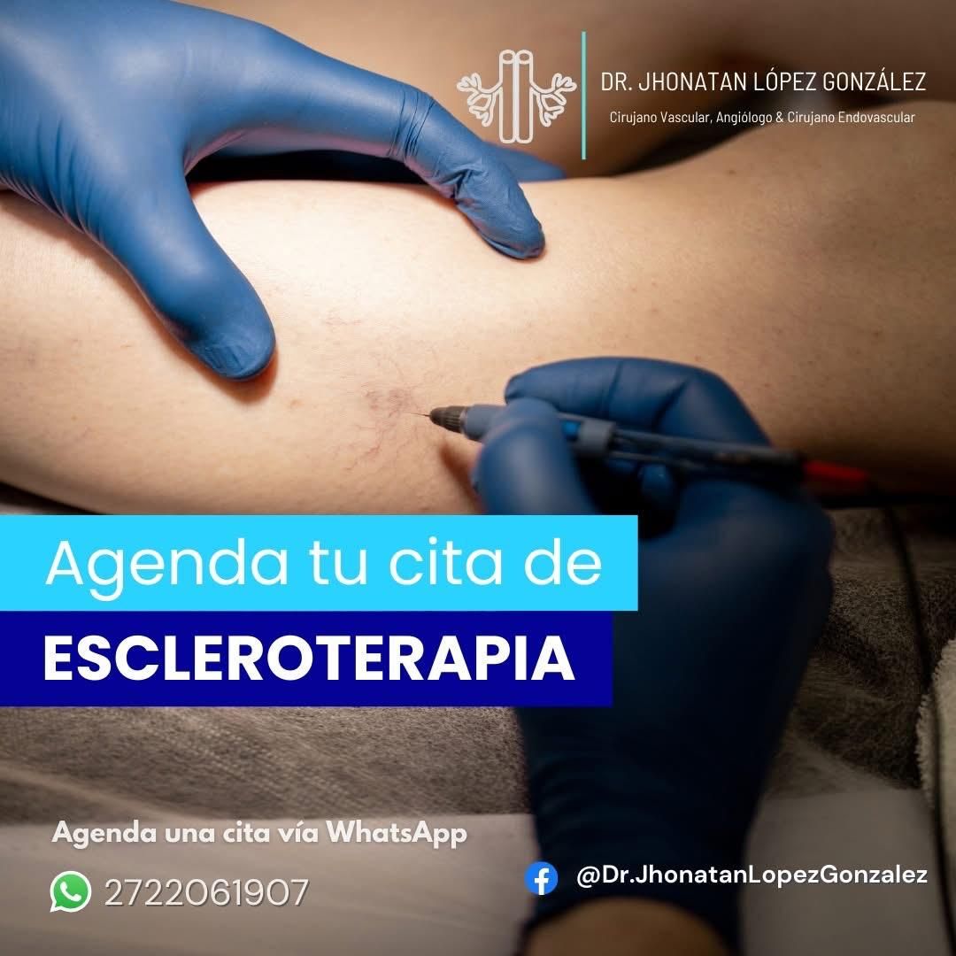 Jhonatan López González-83