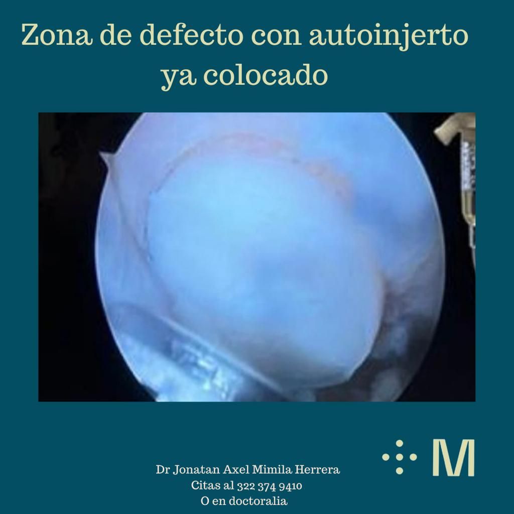 Jonatan Axel Mimila Herrera-16