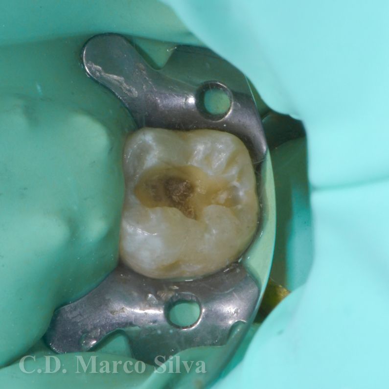 Marco Antonio Silva-15