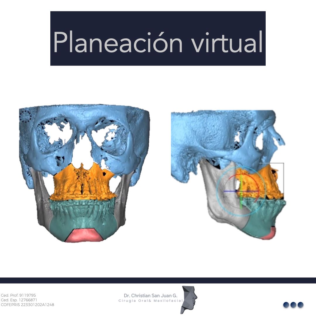 Christian San Juan González-12