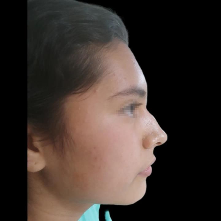 Erendira Santiago Santiesteban-10