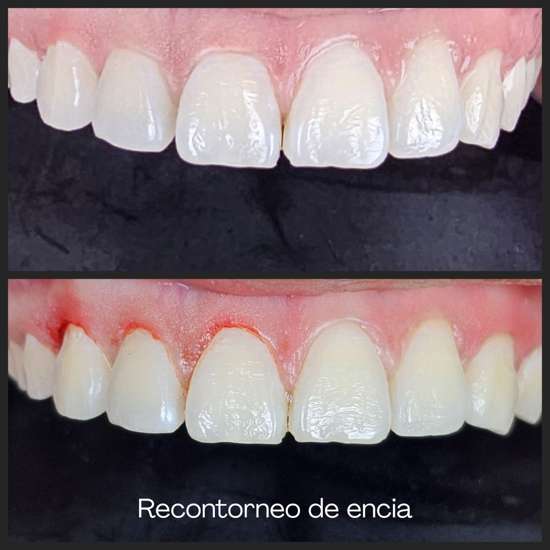 Alejandro Zamora Córdova-22