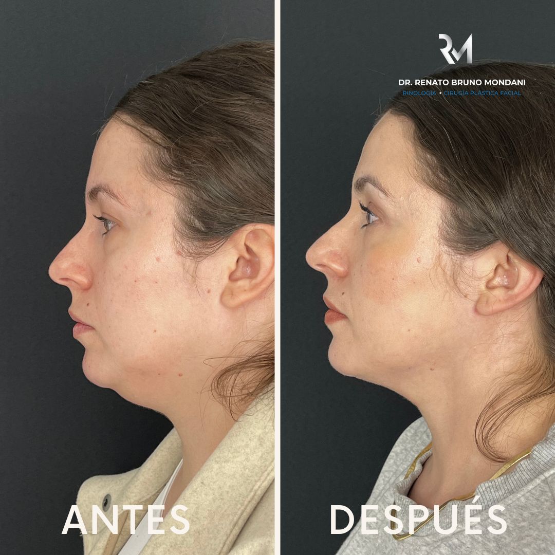 Renato Bruno Mondani-8