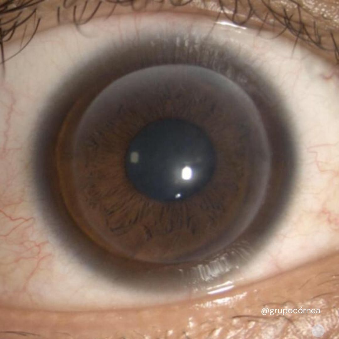 Kristian Alfonso Vazquez Romo-10