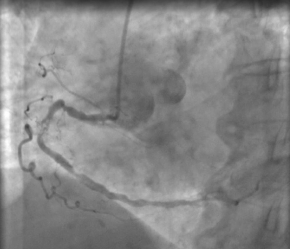 Laura Paola Aceves Chong-4