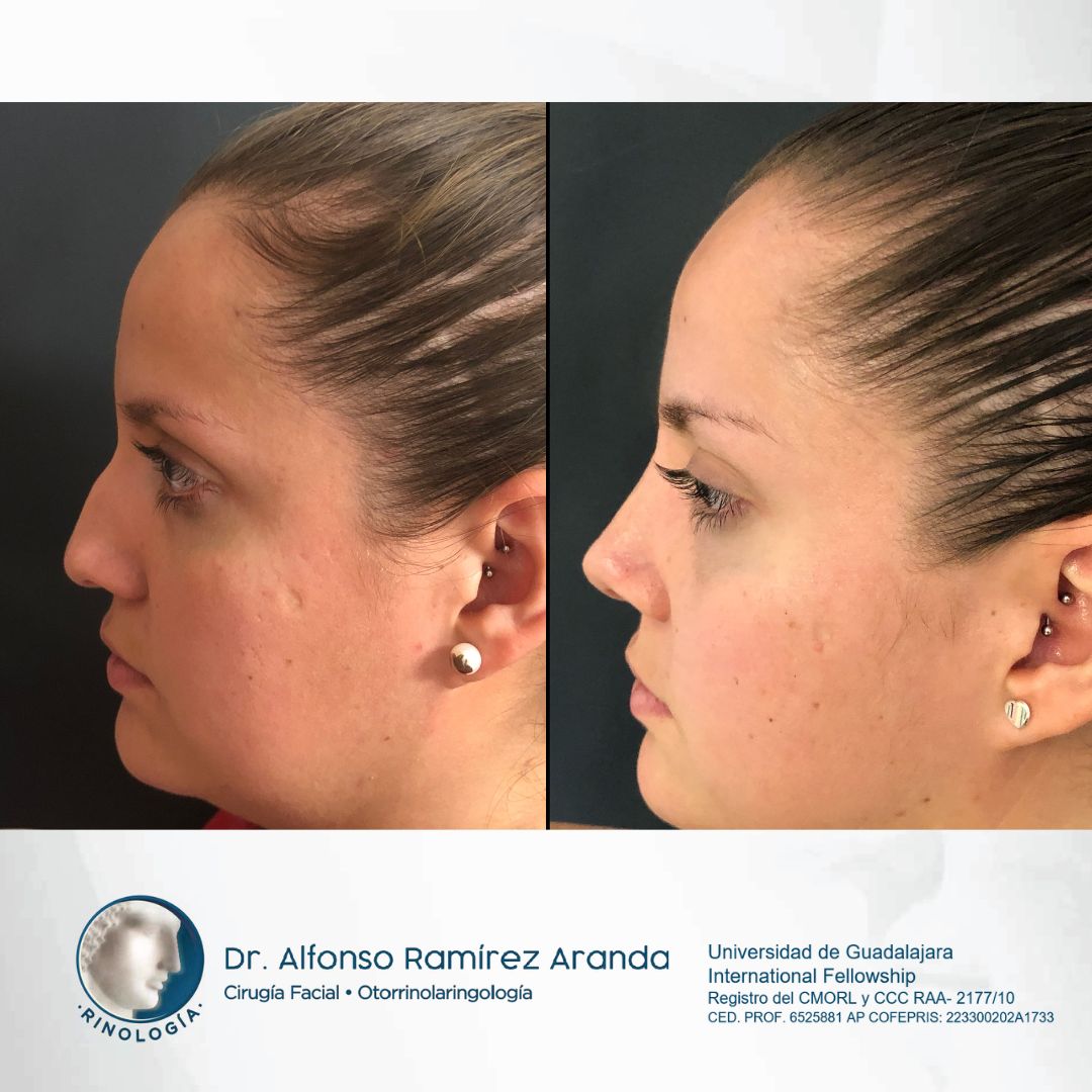 Alfonso Ramírez Aranda-26