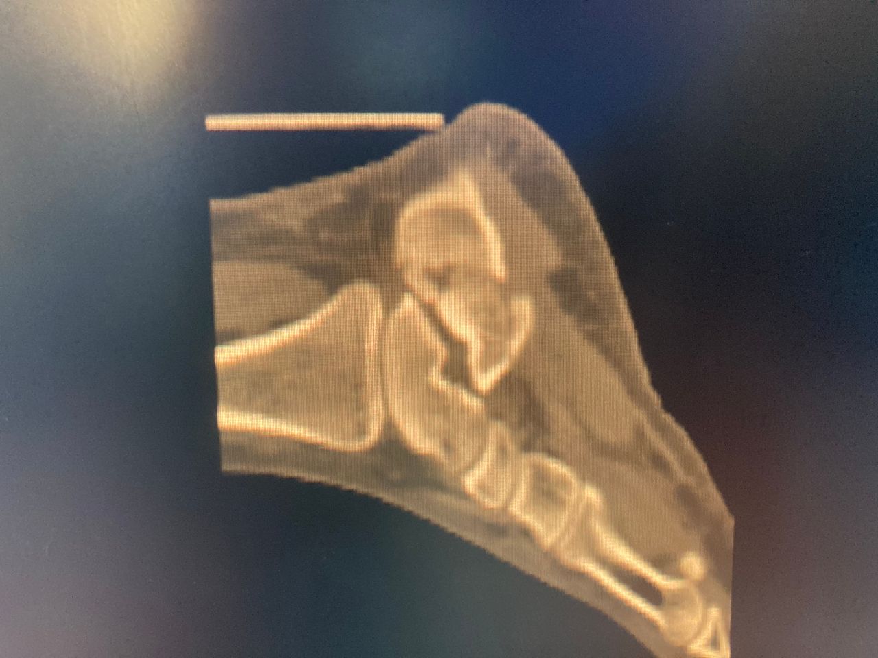 Noe González Plata-7