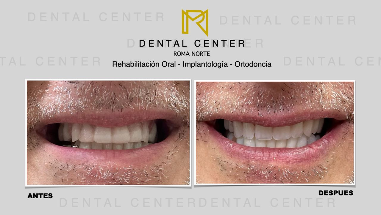 J. Ricardo Martínez-7