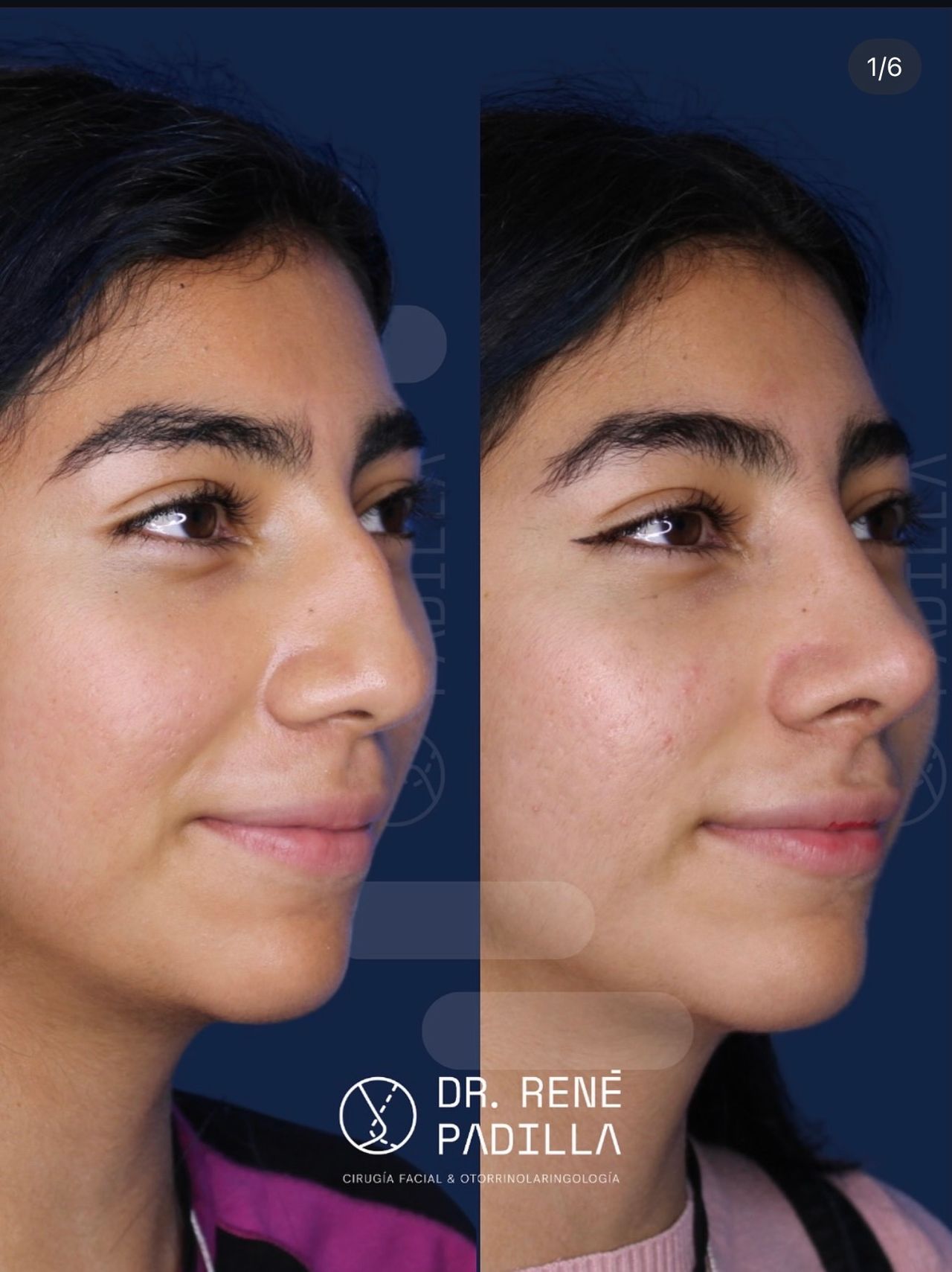 René Emmanuel Padilla López-10