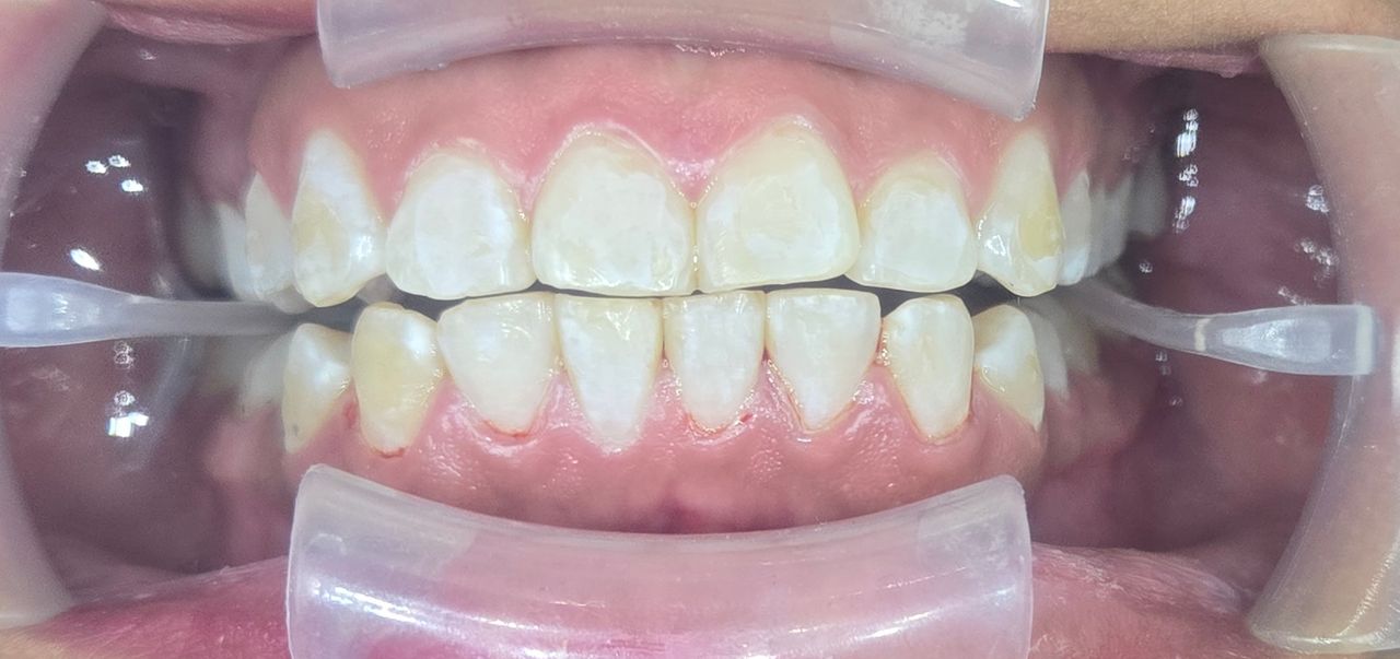 Edgardo Caballero Dávila-12