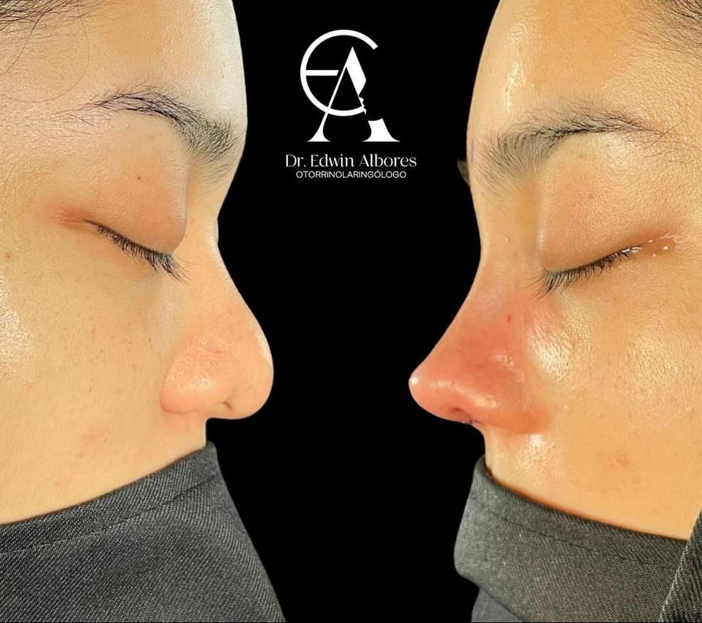 Edwin Hernandez Albores-2