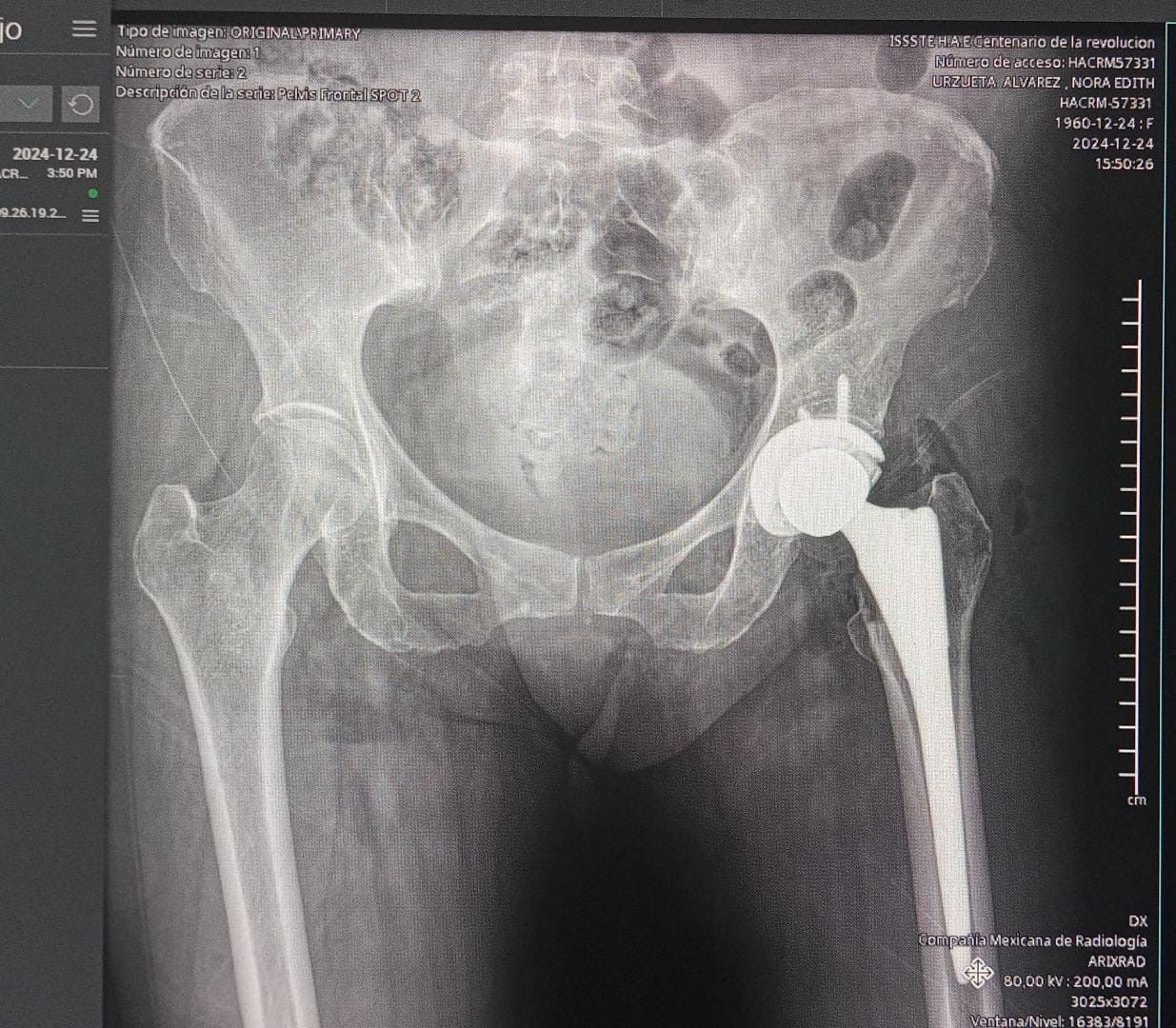 Oscar Iván Giles Mazón-5