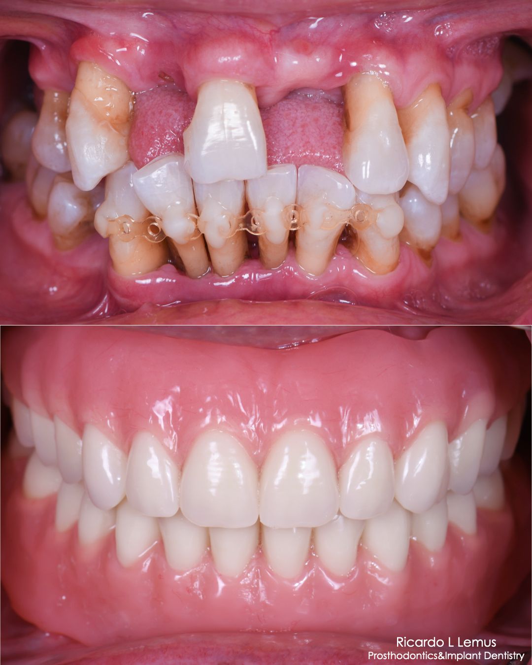 Ricardo López Lemus-95