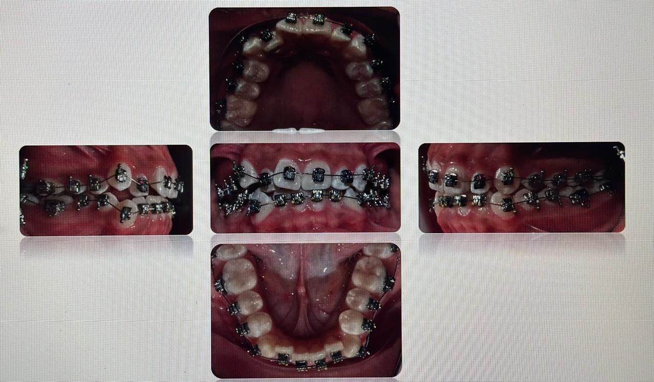 Antonio Gomez Arenas-15