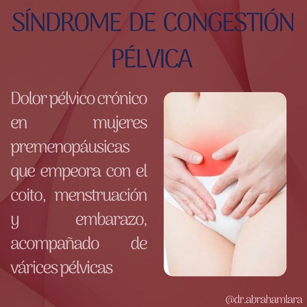 Miguel Abraham Lara Perez-23