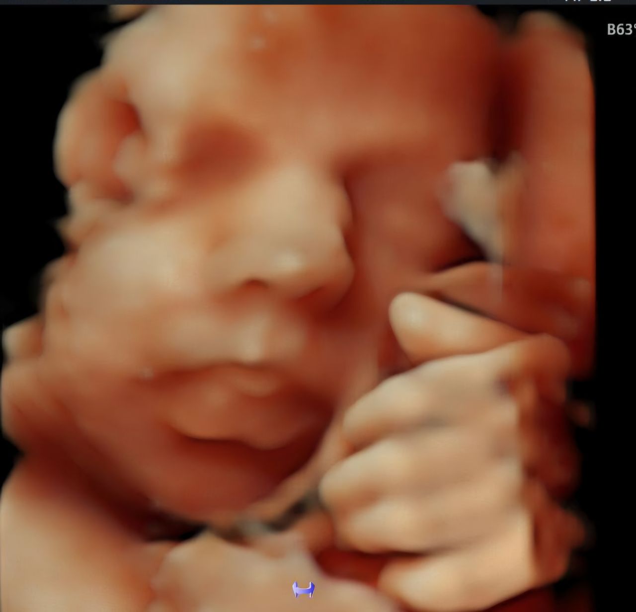 Rubí Tobón Delgado-1