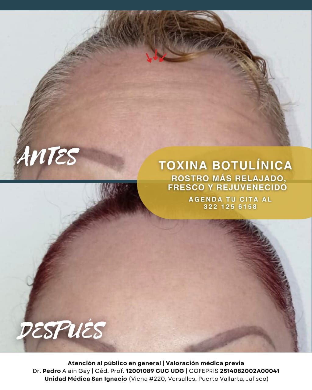 Pedro Alain  Gay Hernández -5