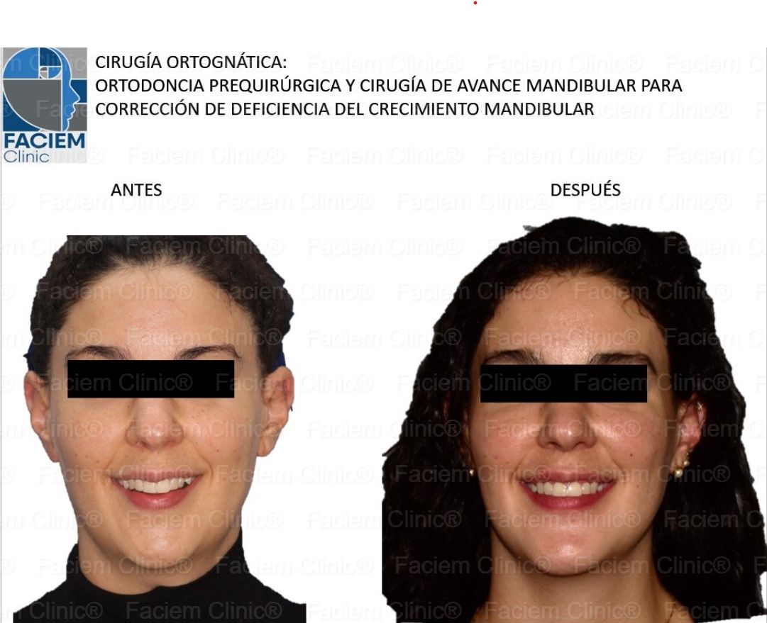 Arlen Colín Ordaz-5