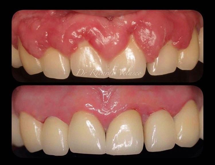 Ricardo Velasco Avelar-11