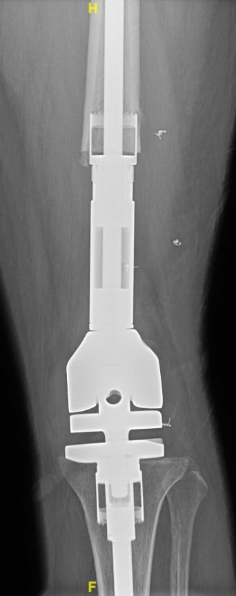 Mayra Deni Peredo Aburto-4