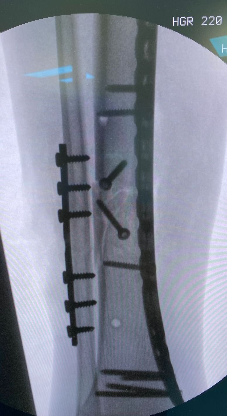 Leonardo Isaac Re-21