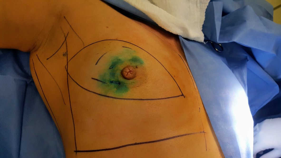 Ángel Millán Juárez-62