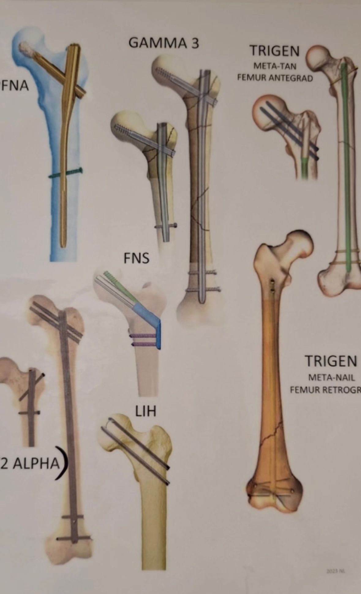 Josué Jonatan Arcia Guzmán-16
