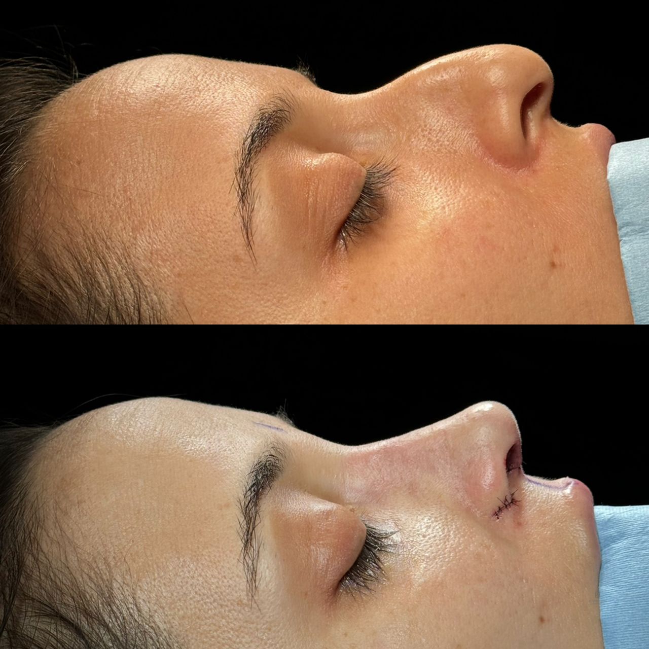 Angel Castro Urquizo-203