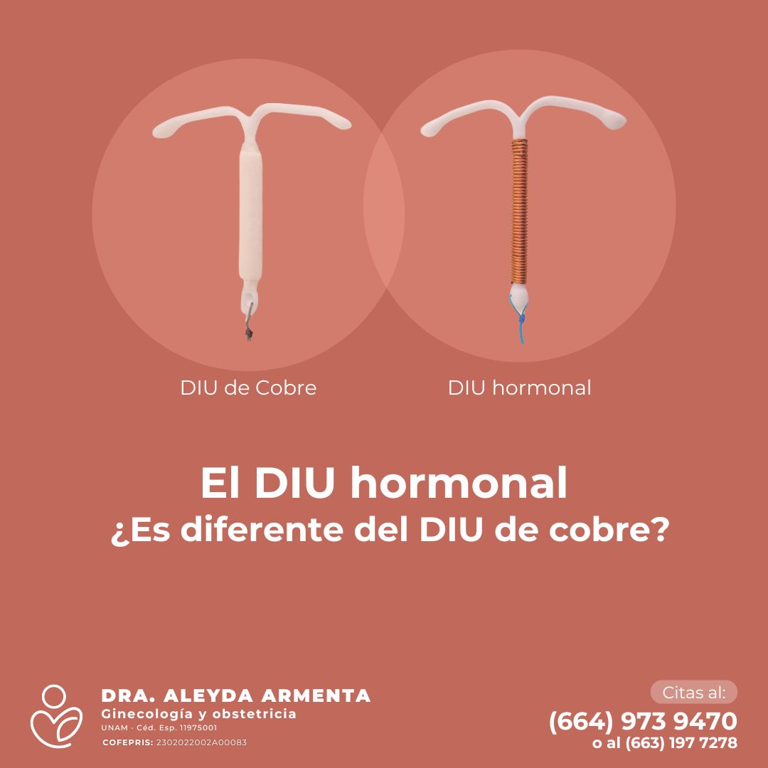 Aleyda Fernanda Armenta Rios-11