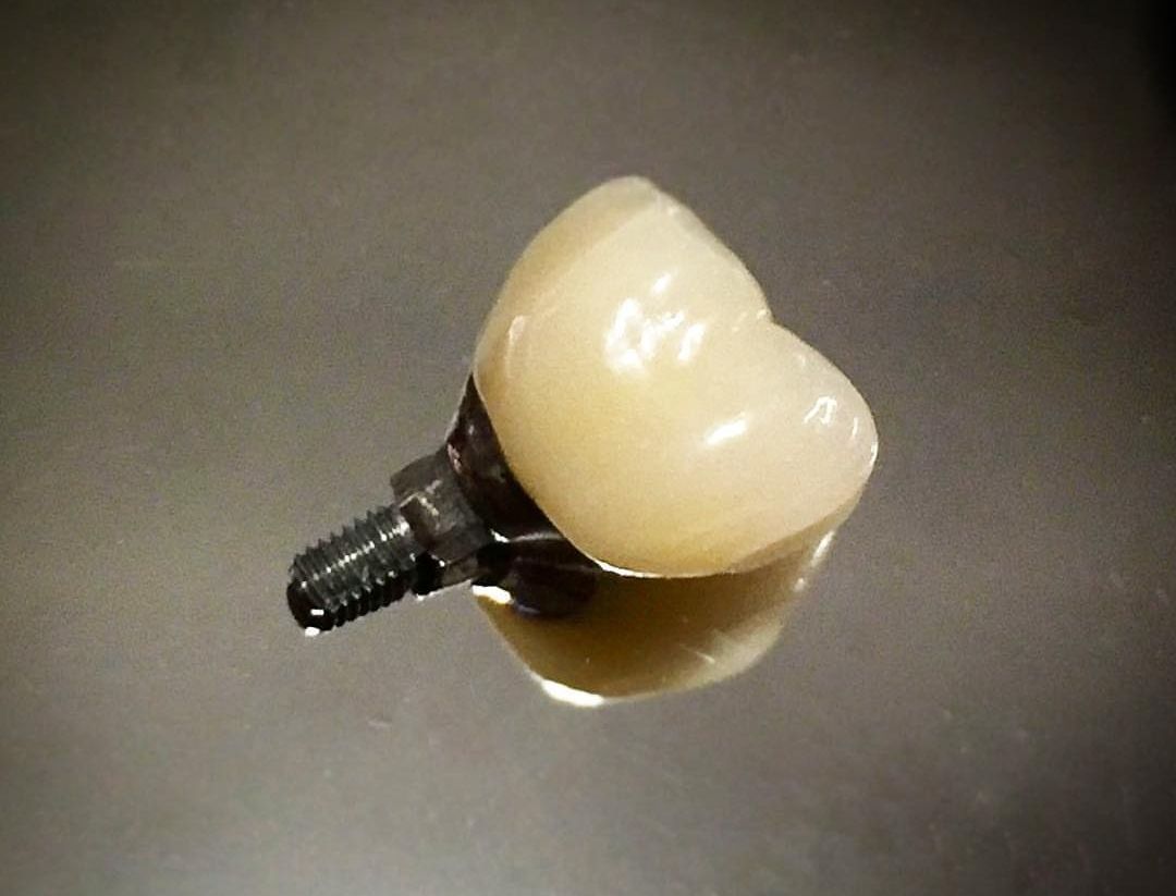 Ilse Méndez Reguera-2