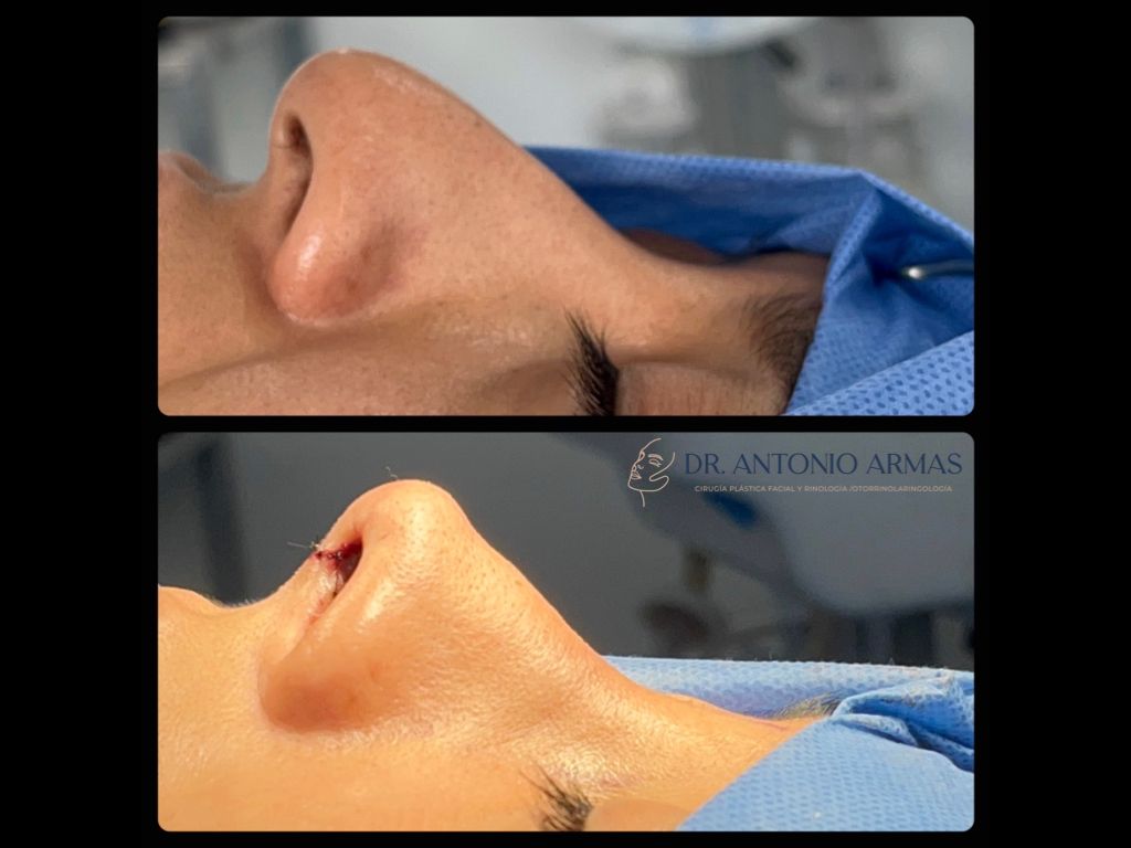 Juan Antonio González Armas-5