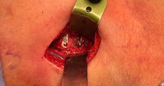 Jose Eduardo Larrinua Betancourt-3