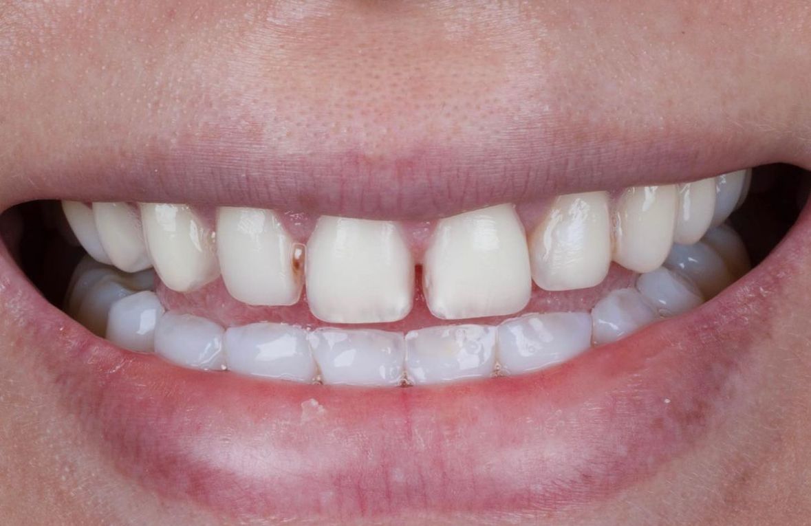 Ricardo Rosado Zamora-14