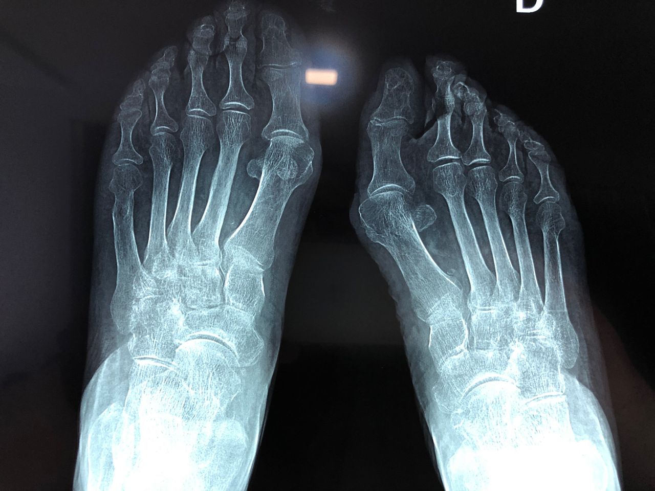 Carlos Ignacio Muñoz Valadez-12