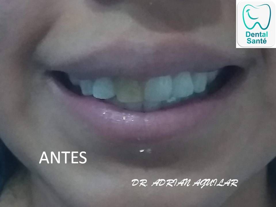 José Adrián Aguilar Arnaud-13