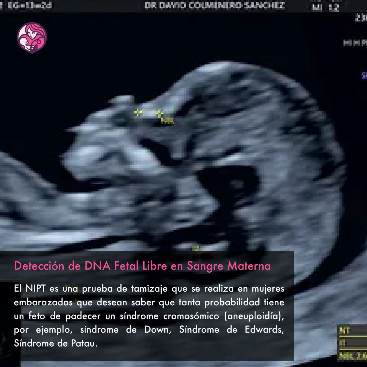 David Colmenero Sánchez-12