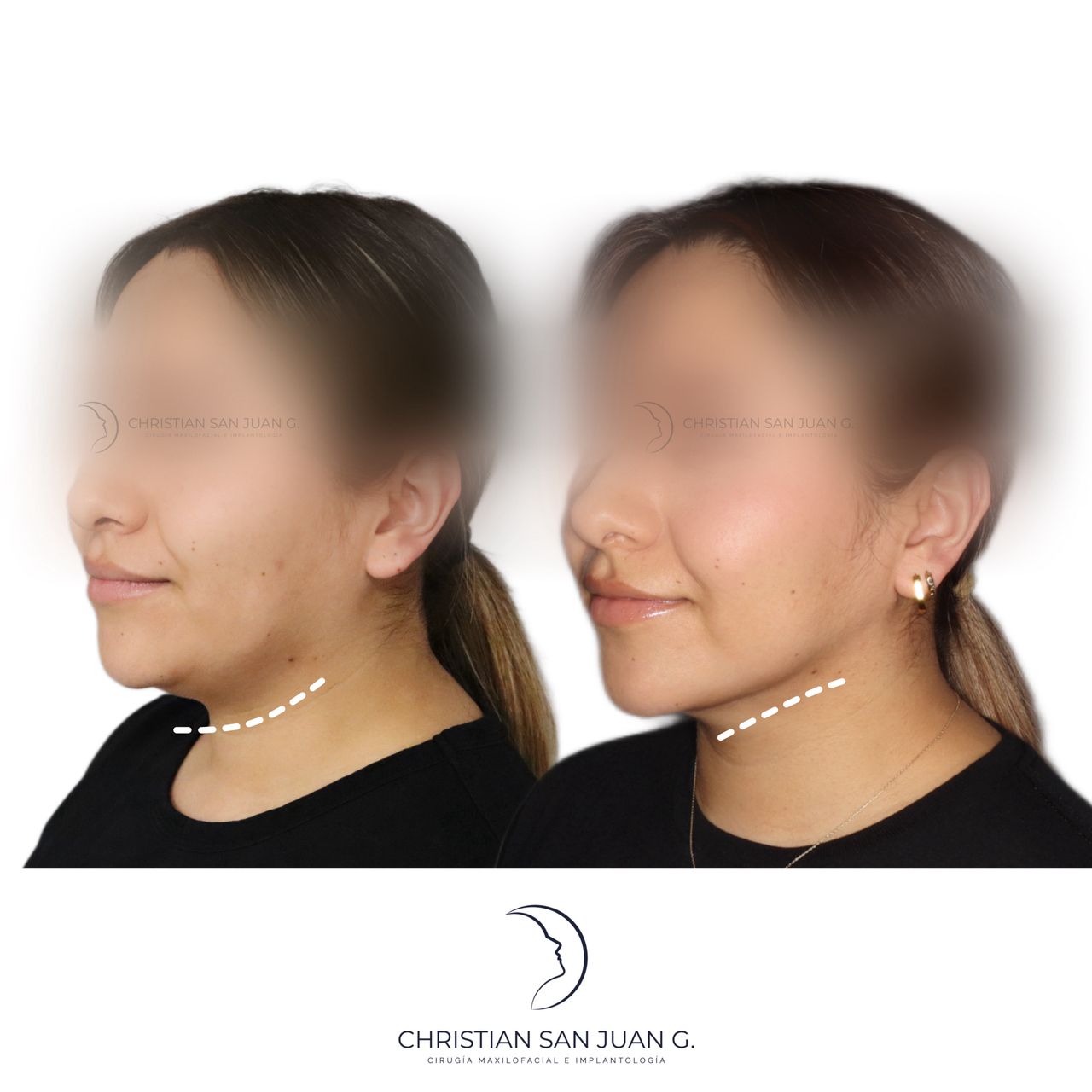 Christian San Juan González-4