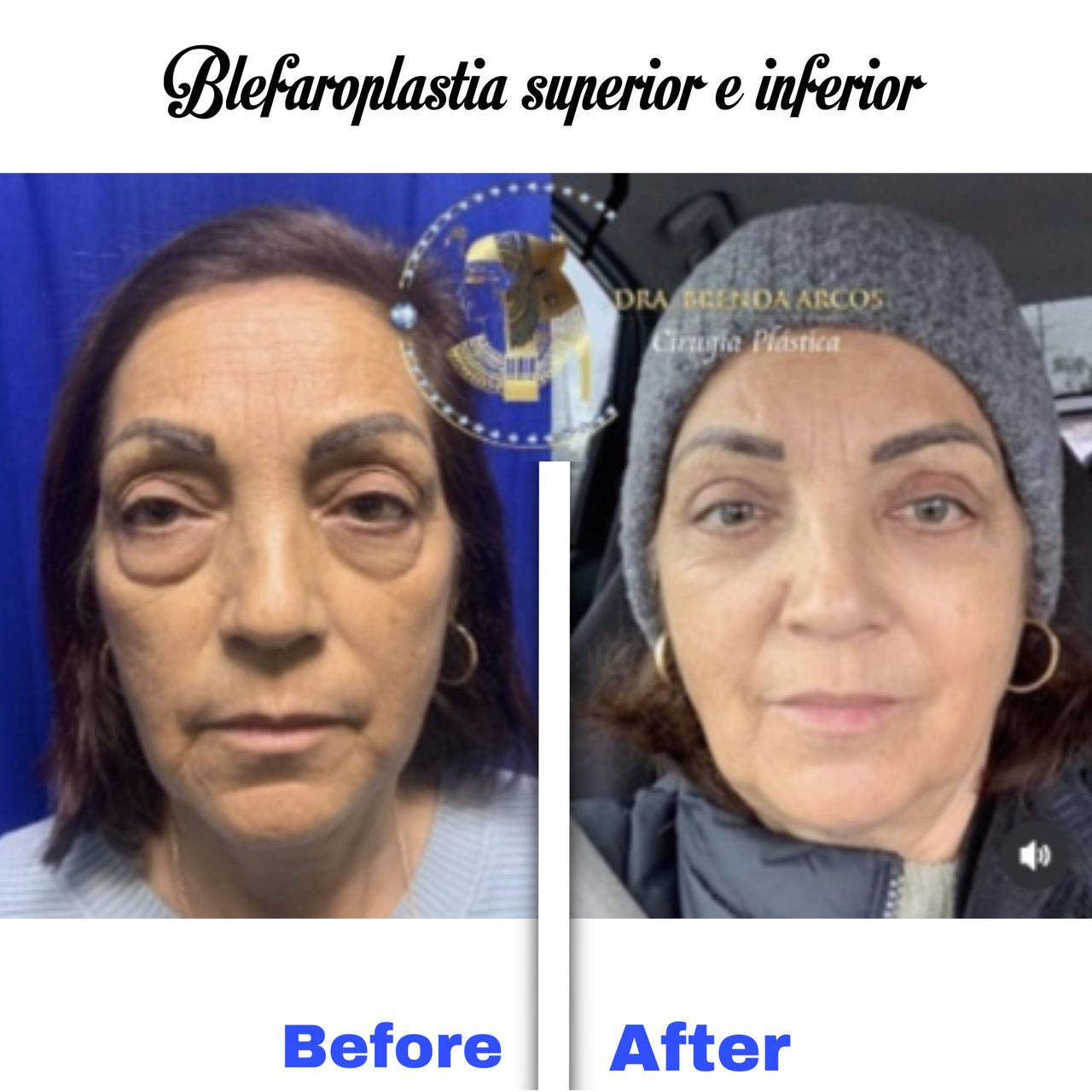 Brenda Arcos Vera-18