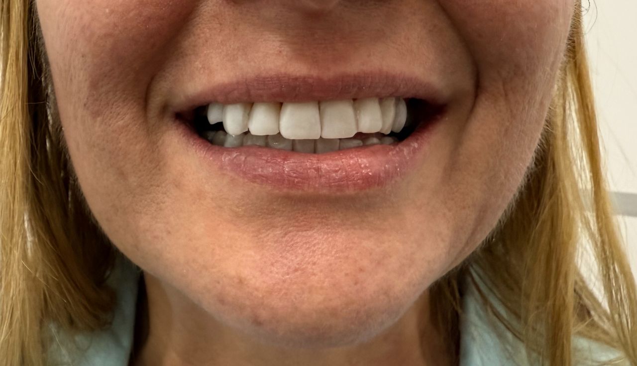 Fernanda Arredondo-5