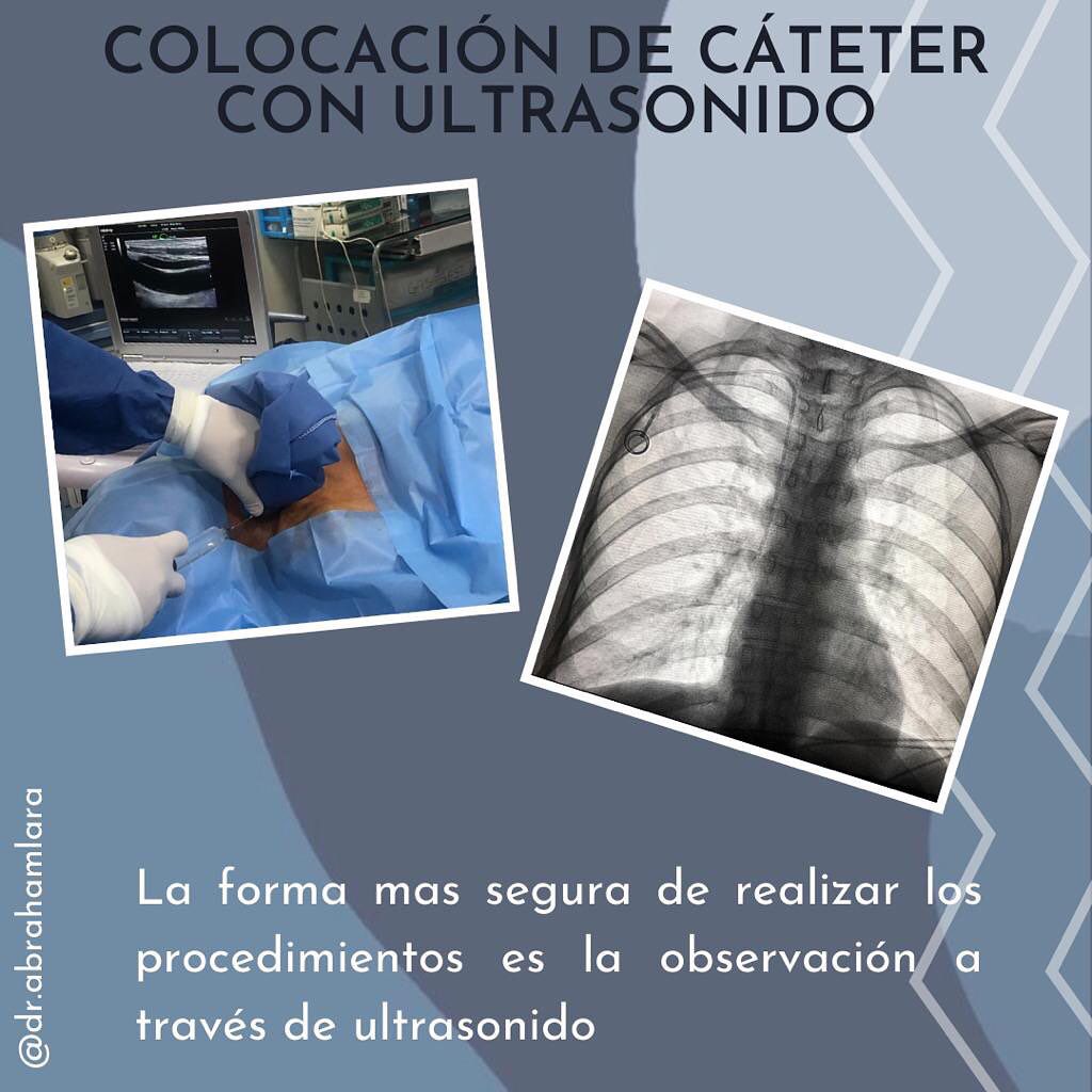 Miguel Abraham Lara Perez-25