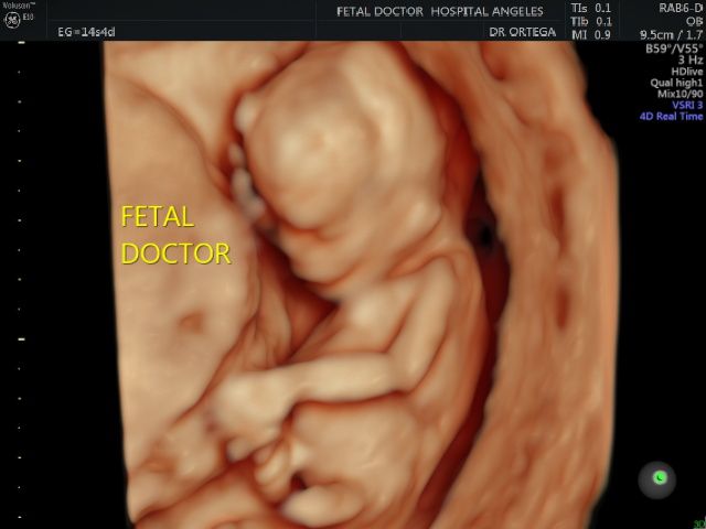 Jesús Manuel Ortega Flores-3