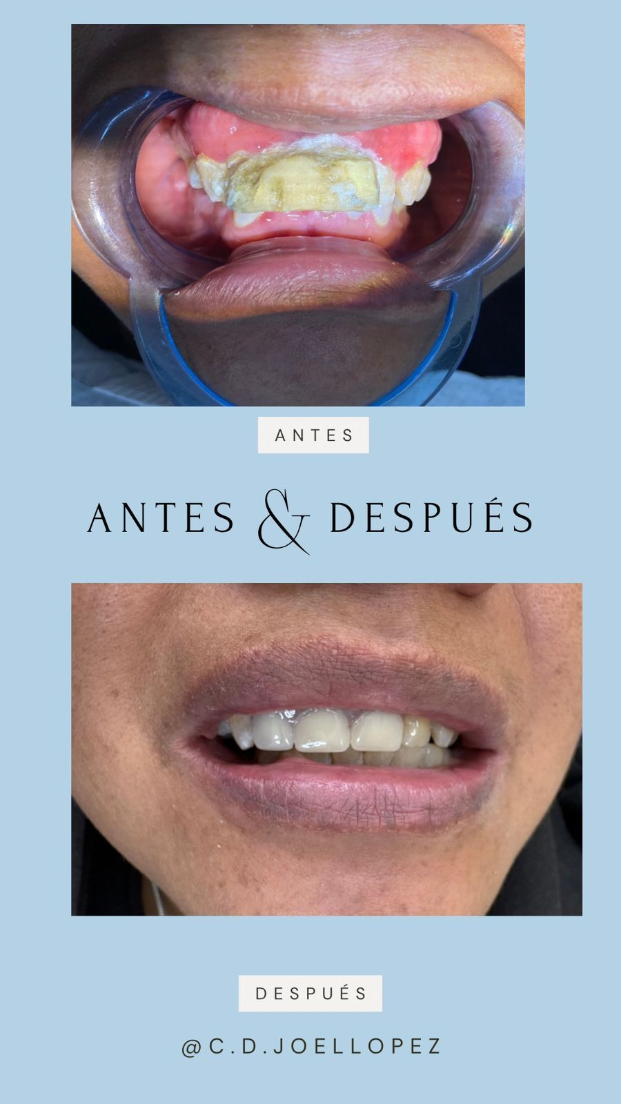 Joel Eduardo Lopez Molina-4